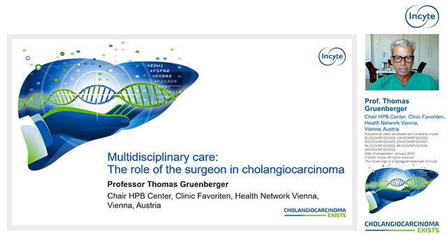 Multidisciplinary care: The role of the surgeon in cholangiocarcinoma Thumbnail