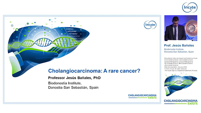 Cholangiocarcinoma: A rare cancer? Thumbnail