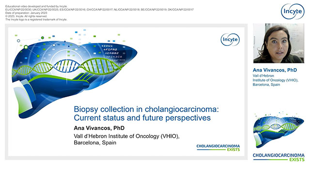 Biopsy collection in cholangiocarcinoma: Current status and future perspectives Thumbnail